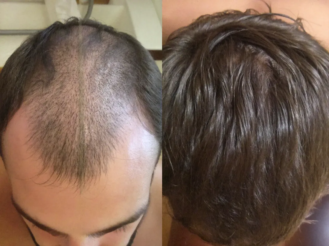 Foto antes y después de Javier