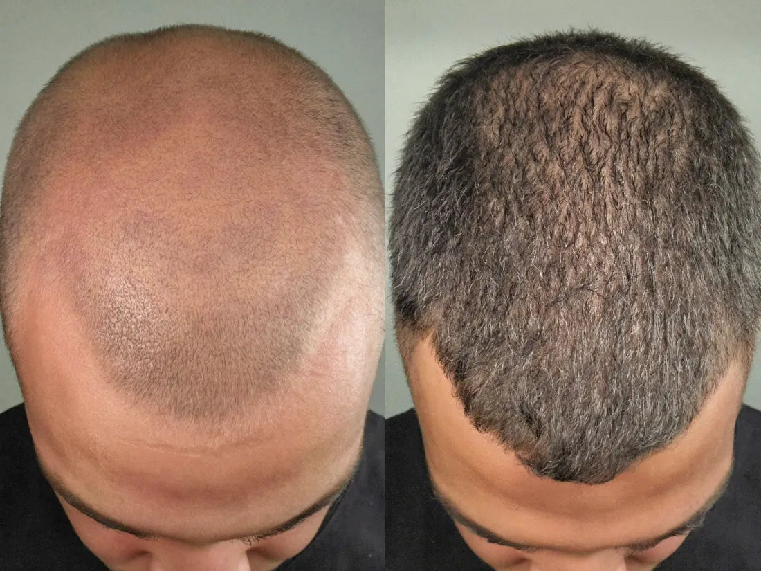Foto antes y después de Sergio