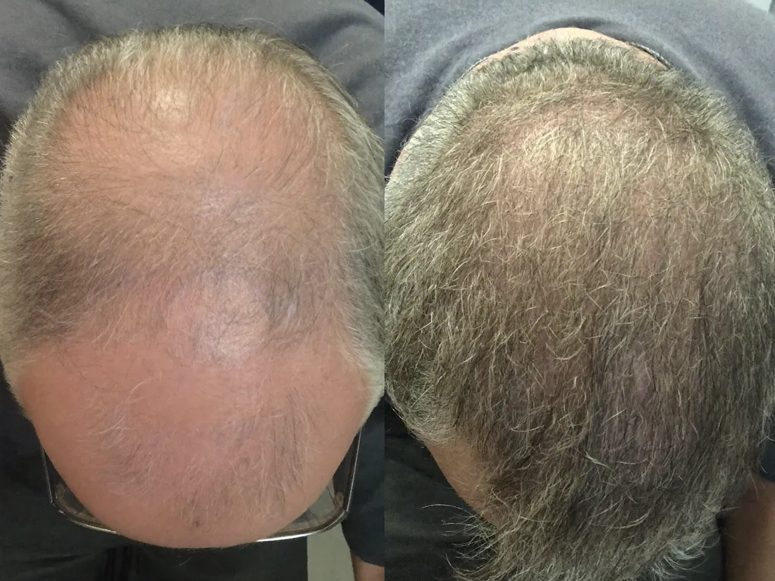 Foto antes y después de Manuel